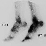 Picture leg 150x150 Visual Quiz 3