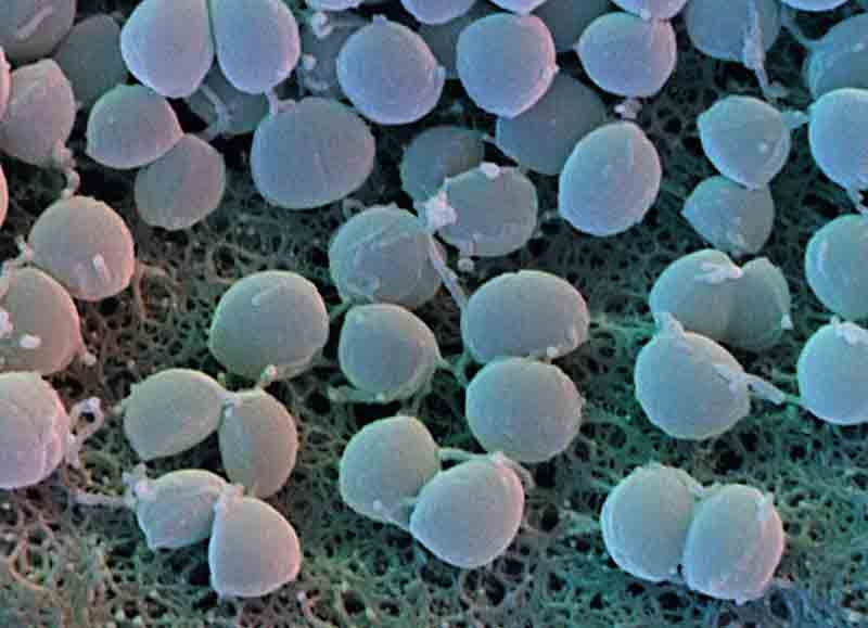 Image result for Staphylococci