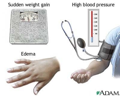 Complications Of Hypertension. Types of hypertension in