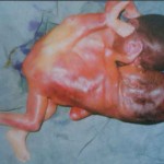 conjoined twins conjoined twins 150x150 Interesting cases picture gallery