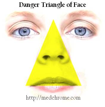 Dangerous area of face