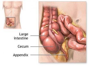 appendix 300x224 Anatomy of Appendix and Appendicitis