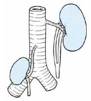 bifid ureter Clinical Anatomy of Ureter
