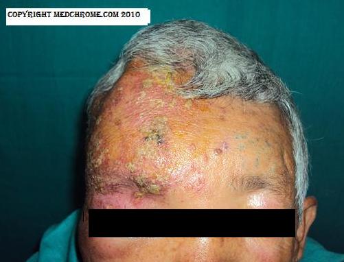 Cases Picture Gallery : Medical Cases