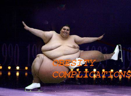 Obesity complications: Associated Pathologies