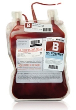 Complications of Blood transfusion and their management