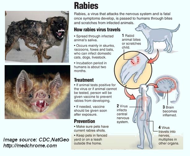 Rabies : Facts, Features and management Guidelines