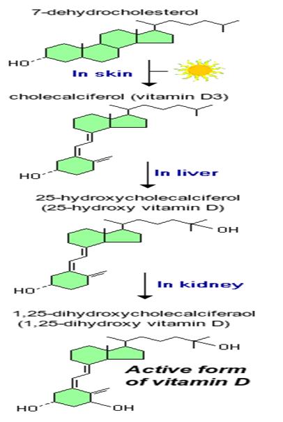 Vitamin D deficiency and Chronic muscle pain