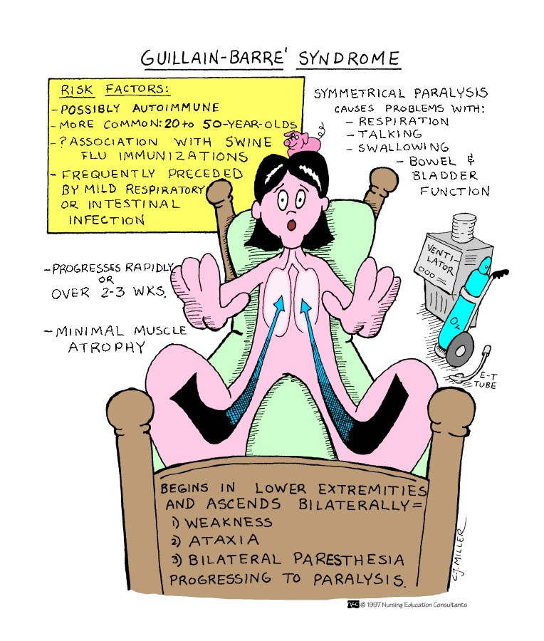 guillain-barre syndrome