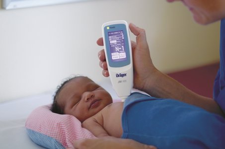 Assessment of Jaundice in Newborn : Tests