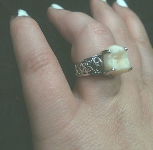 Tooth Ring