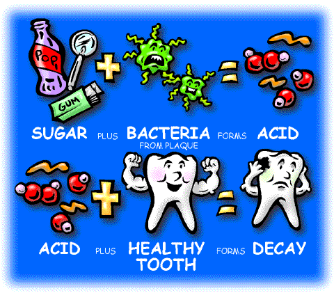 tooth decay acid