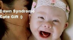 Down Syndrome Baby- 10 common queries