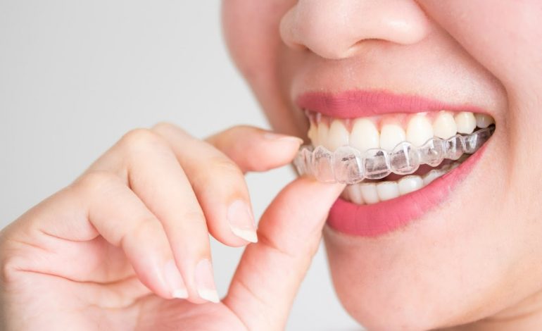 Lingual Braces For Orthodontic Treatment: Is It Right For You?